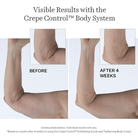 StriVectin Tighten & Lift Crepe Control Body Creams & Treatments, Visibly Reducing Crepey & Saggy Skin, Improves Texture & Tone of Skin