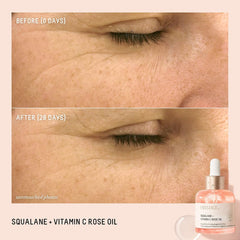 BIOSSANCE Squalane and Vitamin C Rose Oil. Facial Oil to Visibly Brighten, Hydrate, Firm and Reveal Radiant Skin 1.0 ounces