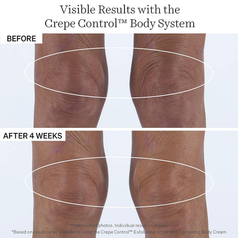StriVectin Tighten & Lift Crepe Control Body Creams & Treatments, Visibly Reducing Crepey & Saggy Skin, Improves Texture & Tone of Skin
