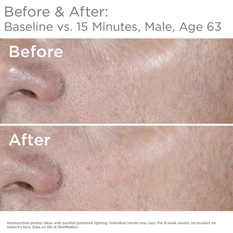 SkinMedica HA5 Rejuvenating Hydrator Hyaluronic Acid Serum for Face with Five Types of Hyaluronic Acid that Smooth Fine Lines and Wrinkles, For All Skin Types, 2 Oz